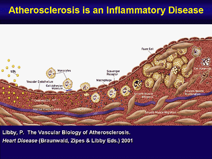 Not known Details About Heart Disease 