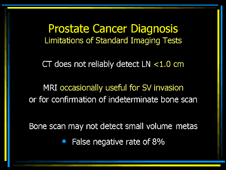 Improving Men's Health: Innovations in the Treatment of Prostate Cancer