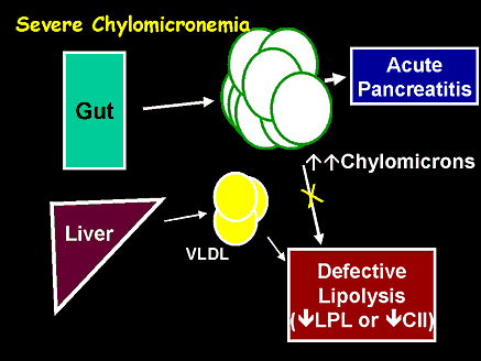 Severe Chylomicronemia