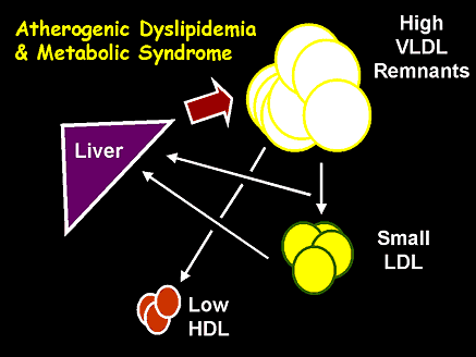 Atherogenic Dyslipidemia and Metabolic Syndrome
