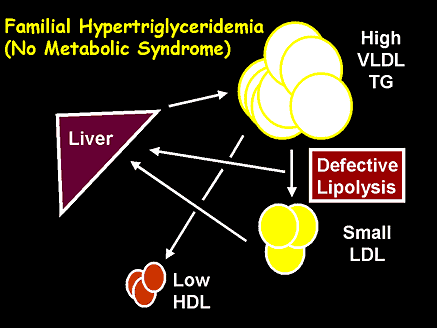 Familial Hypertriglyceridemia (No Metabolic Syndrome)