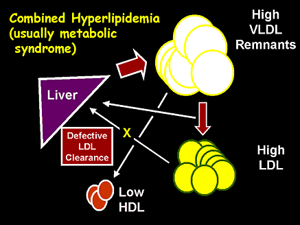 Combined Hyperlipidemia (Usually Metabolic Syndrome)