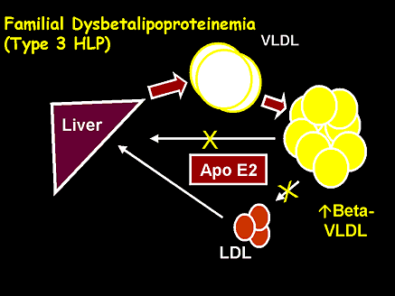 Familial Dysbetalipoproteinemia (Type 3 HLP)