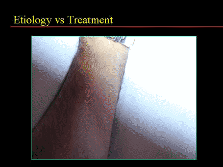 Etiology vs Treatment