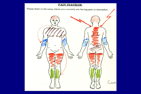 Safe and Effective Management of the Patient with Acute or ... fibromyalgia body diagram 