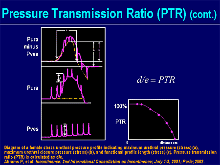 New Horizons in Stress Urinary Incontinence Treatment