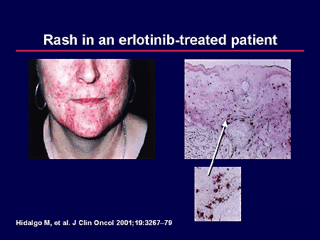 Novel HER1/EGFR-Targeted Agents for Non-Small Cell Lung Cancer: Current ...