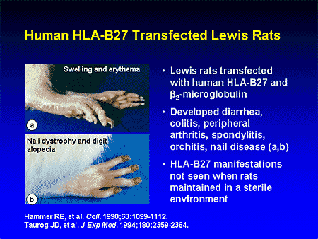 Сдать анализы hla b27. HLA b27. Ген HLA-b27. Антиген HLA b27 положительный. Носительство HLA b27.