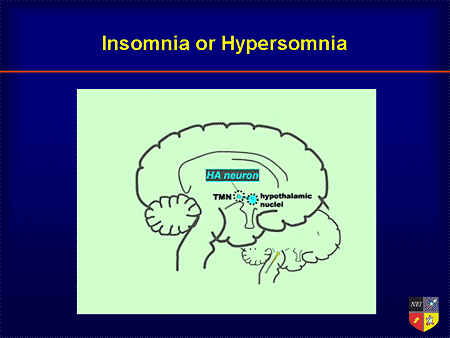 hypersomnia slide brain