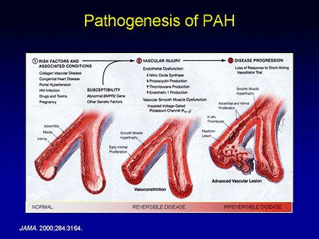 The Art and Science of the Right Heart: Diagnosis and Treatment of ...