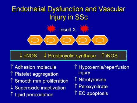 Systemic Sclerosis: An Integrated Approach to Understanding ...