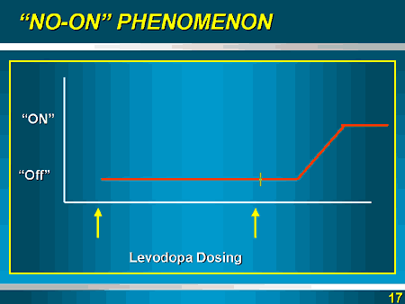 Levodopa-Continuous Dopaminergic Stimulation In The Treatment Of ...