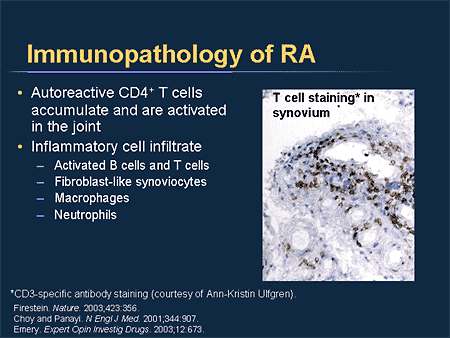 Immunopathology of RA