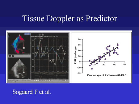 Tissue Doppler as Predictor