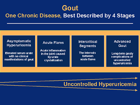 clinical presentation of gout and hyperuricemia