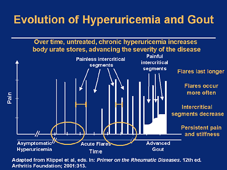 Hyperuricemia And Gout