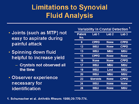 synovial fluid analysis chart synovial fluid analysis chart