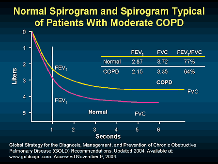 COPD Exchange: Inspirational Medical Education