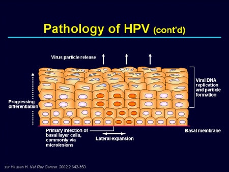 human papillomavirus pathology