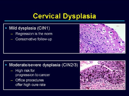 Preventing Cervical Cancer and Other HPV-Related Diseases