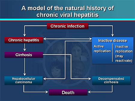 Chronic Hepatitis B: Refining Management Approaches And Addressing The ...