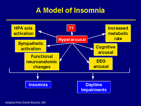 Slide 38. A Model of Insomnia