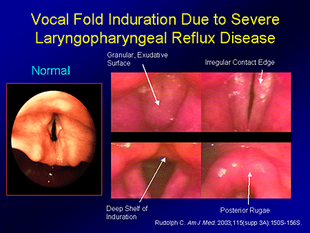 Pediatric GERD: A Problem-Based Approach to Understanding ...