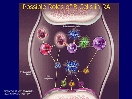 B-Cell Targeted Therapies: The Future Of RA Targeted Management