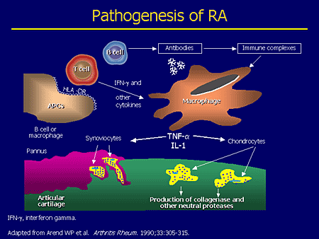 B-Cell Targeted Therapies: The Future of RA Targeted ...