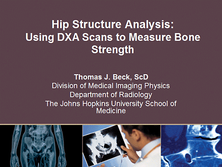 Bone Densitometry  Johns Hopkins Medicine