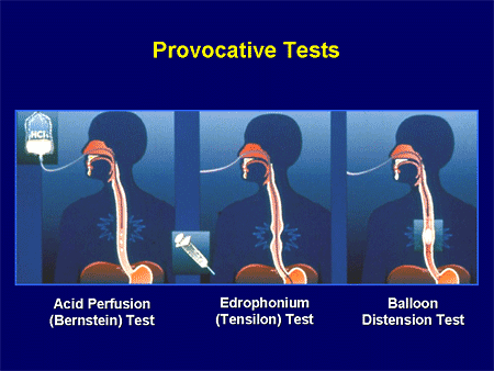 gif heart test Approaches Revisiting to the Management Complex of