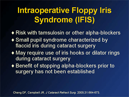 Floppy iris syndrome что это