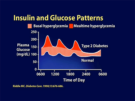 Insulin-Treated Type 2 Diabetes: Balancing Physiologic and Individual Needs