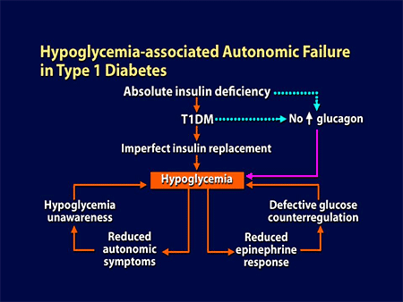 Insulin Treated Type 2 Diabetes Balancing Physiologic And Individual Needs