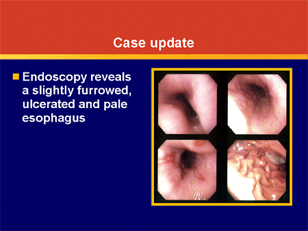 Clinical Inquiries in Pediatric Acid-related Disorders