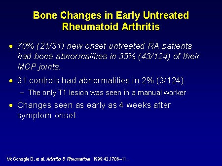 Changing the Treatment of Rheumatic Diseases: Optimal Use of Biologic ...