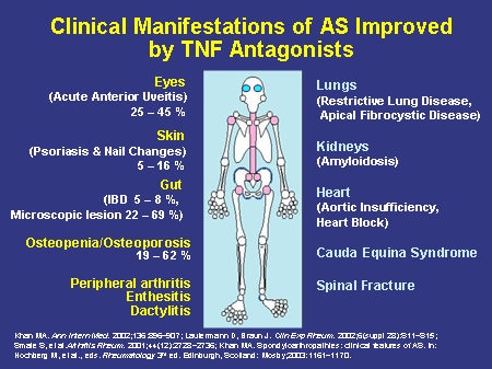 Changing The Treatment Of Rheumatic Diseases: Optimal Use Of Biologic ...