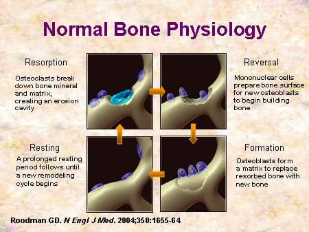 Emerging Opportunities for Bisphosphonates in Metastatic Bone Disease