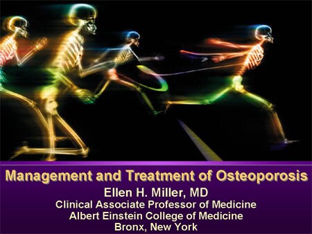 Management and Treatment of Osteoporosis