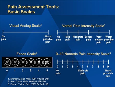 Advances in Neuropathic Pain: Uncomplicated Painful Diabetic ...