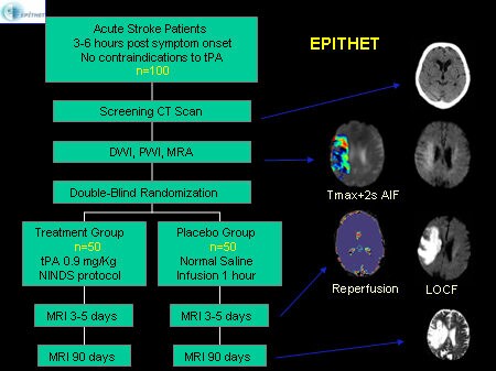 Applying Advances in Brain Imaging in Diagnosing Stroke Selection for ...