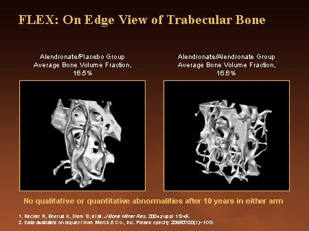 FLEX: On Edge View of Trabecular Bone