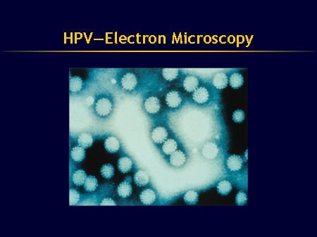 Disease Burden and Health Consequences of HPV Infection (Slides with