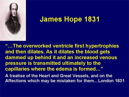 James Hope 1831