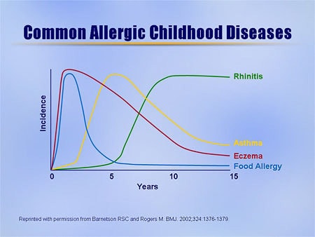 Atopic Dermatitis Cartoon Controlling Disease for Optimal Outcomes New Paradigms in 