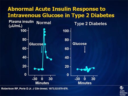 The Pathophysiology of Type 2 Diabetes: New Perspectives and Their ...