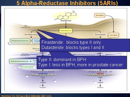 5 Alpha Reductase Inhibitors 5aris 5 Alpha Reductase Inhibitors 5aris