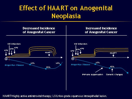 Slide 17.