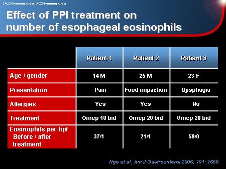 Eosinophilic esophagitis - Symptoms and causes - Mayo Clinic