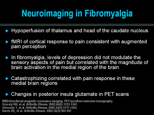 Fibromyalgia: Evidence-based Tx